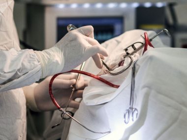 Китайские врачи провели удаленно операцию на сердце через сети 5G