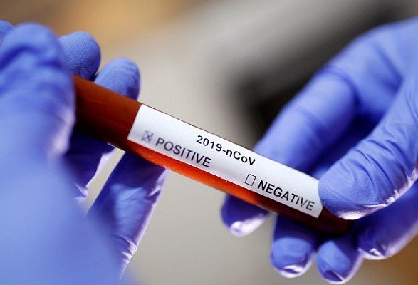 В Украине начали разработку тестов для диагностики коронавируса
