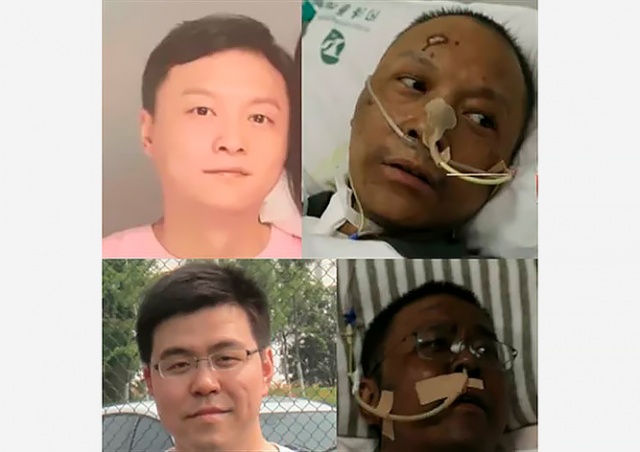 У двух китайских врачей коронавирус изменил цвет кожи