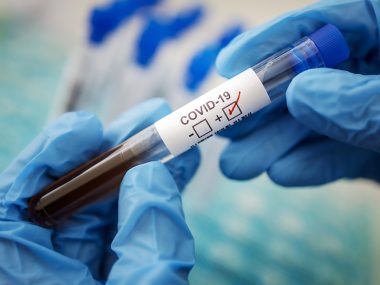 В Китае провели успешные тесты вакцины от Covid-19 на обезьянах