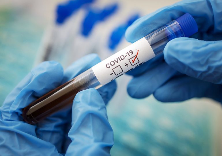 В Китае провели успешные тесты вакцины от Covid-19 на обезьянах